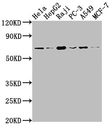 Anti-ALAS1 Recombinant Monoclonal, clone 2A9