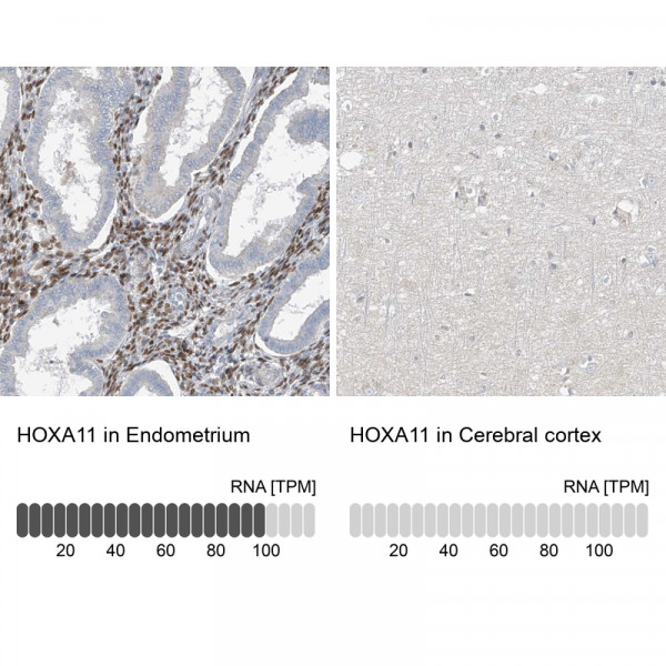 Anti-HOXA11