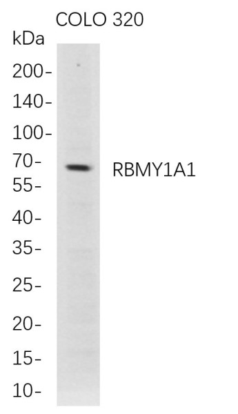 Anti-Recombinant RBMY1A1, clone 5D5
