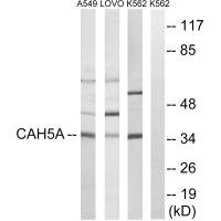Anti-CA5A