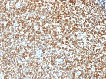 Anti-NKX2.2 (Neuroendocrine &amp; Ewing s Sarcoma Marker) (clone: NX2/1422R) (recombinant rabbit monoclo