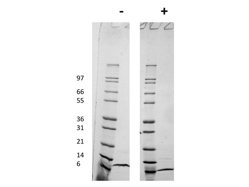 Monocyte Chemotactic Protein-2 (CCL8)