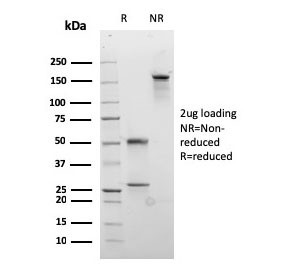 Anti-Desmocollin 2/3 (recombinant antibody), clone rDSC2/3437