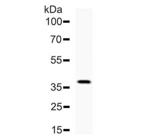 Anti-DKK1