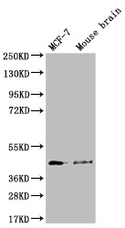Anti-SLC27A4 Recombinant Monoclonal, clone 11A1