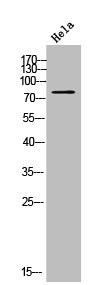 Anti-CYP21A2