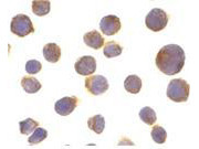 Anti-Death Receptor 4