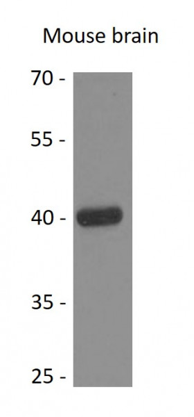 Anti-Wnt3a