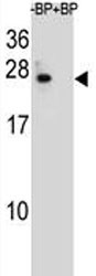 Anti-Bcl-2