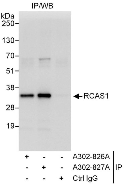 Anti-RCAS1