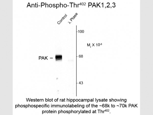 Anti-phospho-PAK 1/2/3 (Thr402)