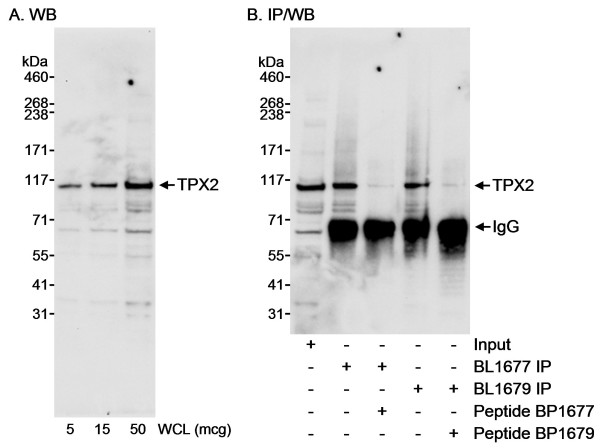 Anti-TPX2