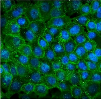 Anti-P-Cadherin / CDH3, clone 3C9
