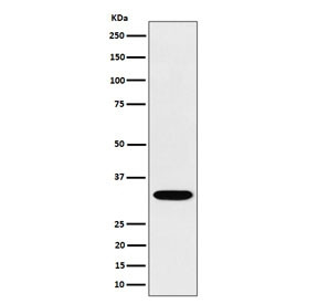 Anti-TSFM / Elongation factor Ts, clone 29T44