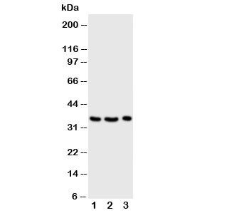 Anti-Granzyme A