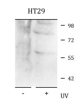 Anti-phospho-CHEK1 (Ser345)