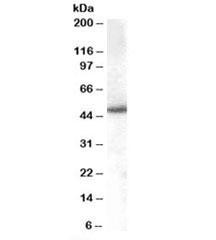 Anti-SNX5