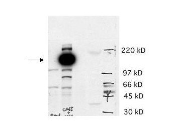Anti-Cas5