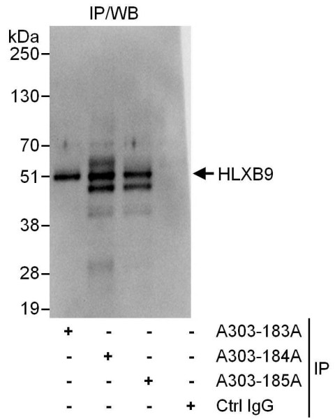 Anti-HLXB9
