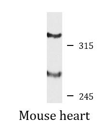 Anti-Desmoplakin I+II