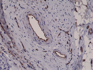 Anti-CD31 (human), Rabbit Monoclonal (RM247)