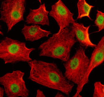 Anti-EIF4A3 / Eukaryotic initiation factor 4A-III