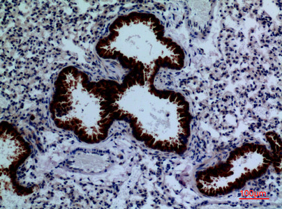 Anti-DPYD