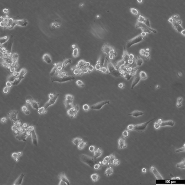 SK-HEP-1 Cells