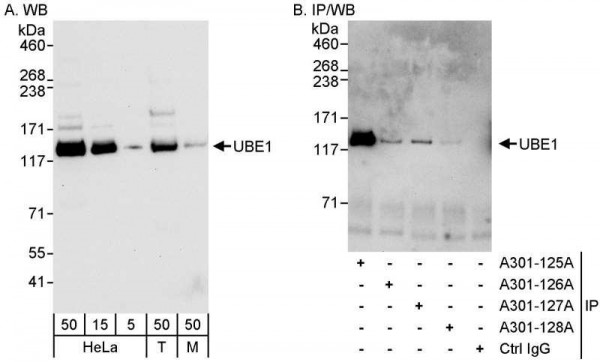 Anti-UBE1