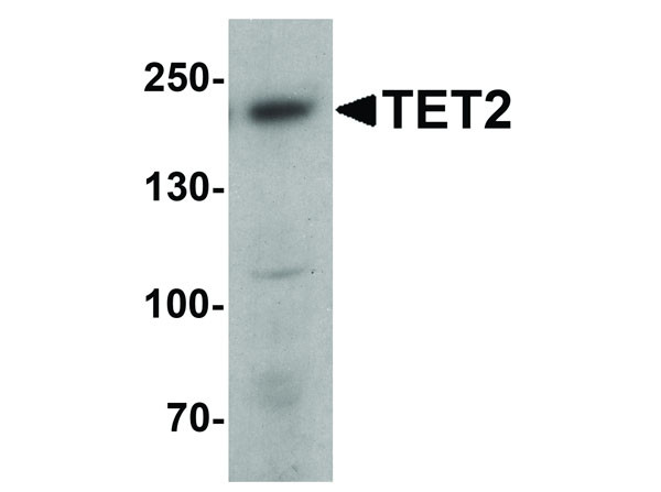 Anti-TET2