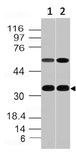 Anti-CD20 (Clone: ABM46C7)