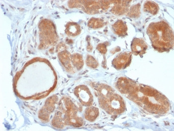 Anti-STAT5b, clone STAT5B/2611