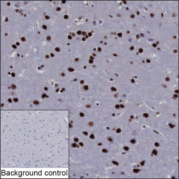 Anti-Matrin-3