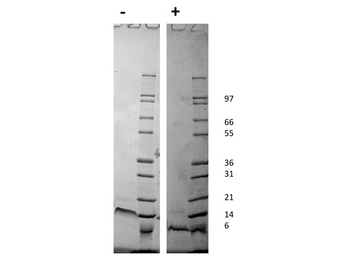 Stromal Cell-Derived Factor-1 alpha (CXCL12)