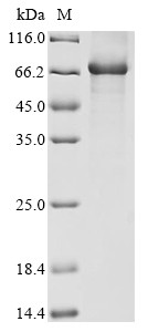 T-box transcription factor TBX5 (TBX5), human, recombinant
