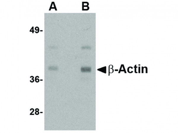 Anti-Beta-actin