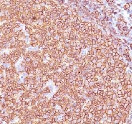 Anti-CD20 (B-cell marker), clone SPM618