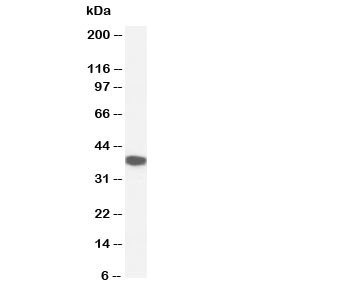 Anti-Kallikrein-5