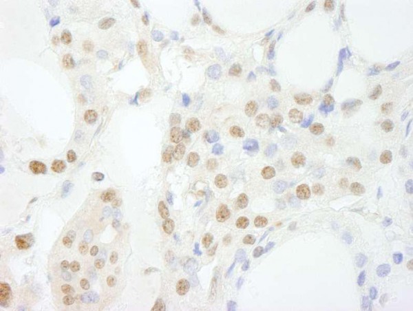 Anti-GTF3C3/TFIII1C102 IHC Antibody, affinity purifie (IHC)