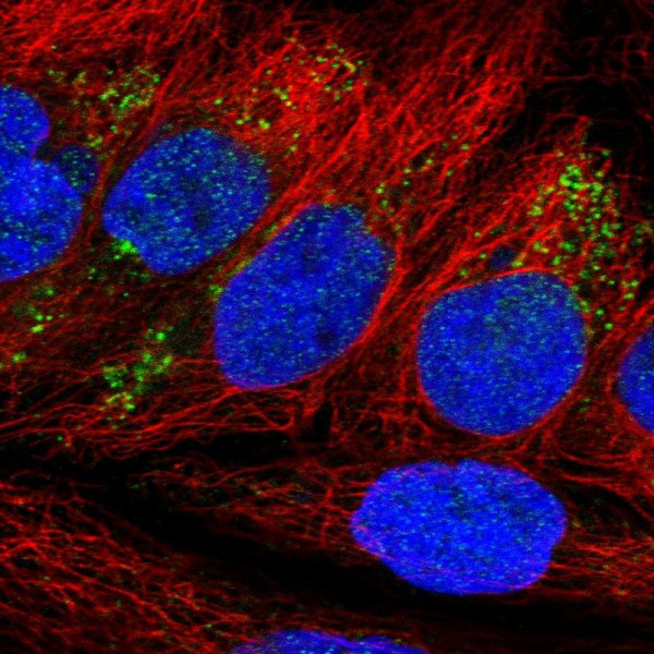 Anti-NDFIP2