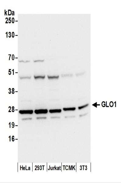Anti-GLO1/Glyoxalase I