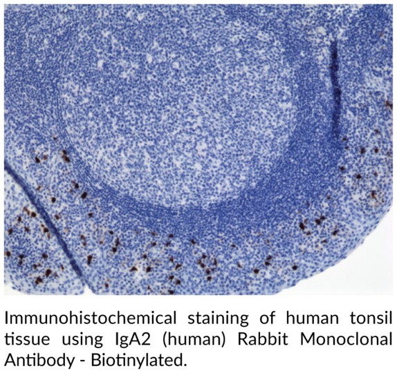 Anti-IgA2 (human) Rabbit Monoclonal Antibody - Biotinylated (Clone RM125)