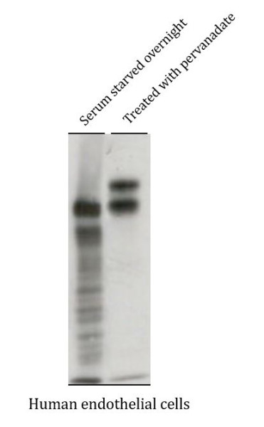 Anti-BCAR1 / p130 Cas, clone M144