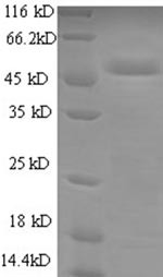 Cytochrome b-c1 complex subunit Rieske, mitochondrial (UQCRFS1), human, recombinant