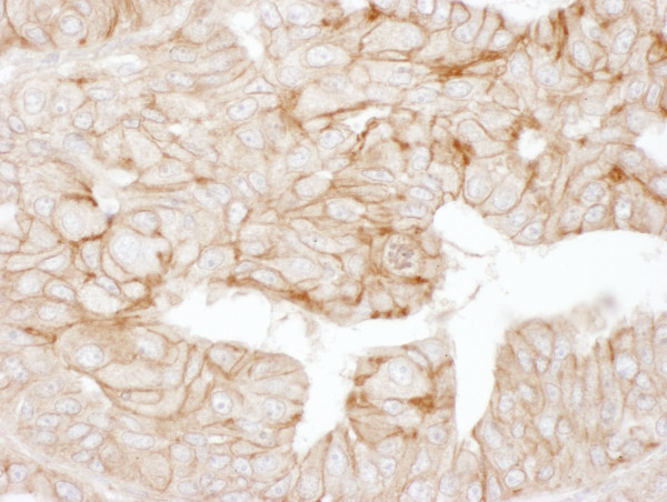 Anti-Alpha-Adducin