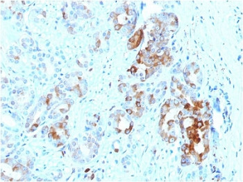 Anti-FTL1 / Ferritin light chain, clone FTL/1387