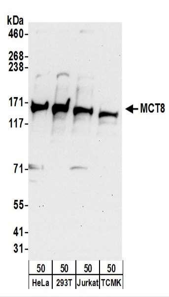 Anti-MCT8