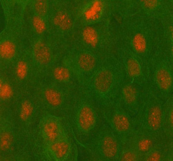 Anti-PBX4 / Pre-B-cell leukemia transcription factor 4