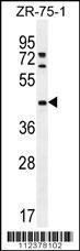 Anti-METTL2, CT (METTL2A, METTL2, Methyltransferase-like protein 2A)