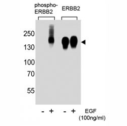 Anti-HER2 (ERBB2) (phospho-Y1139)